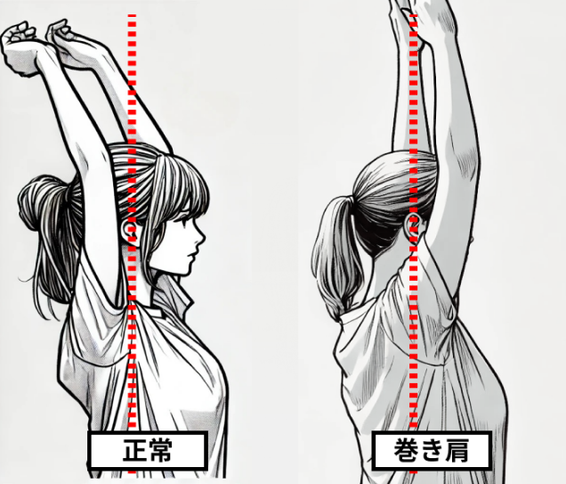 巻き肩チェック解説イメージ