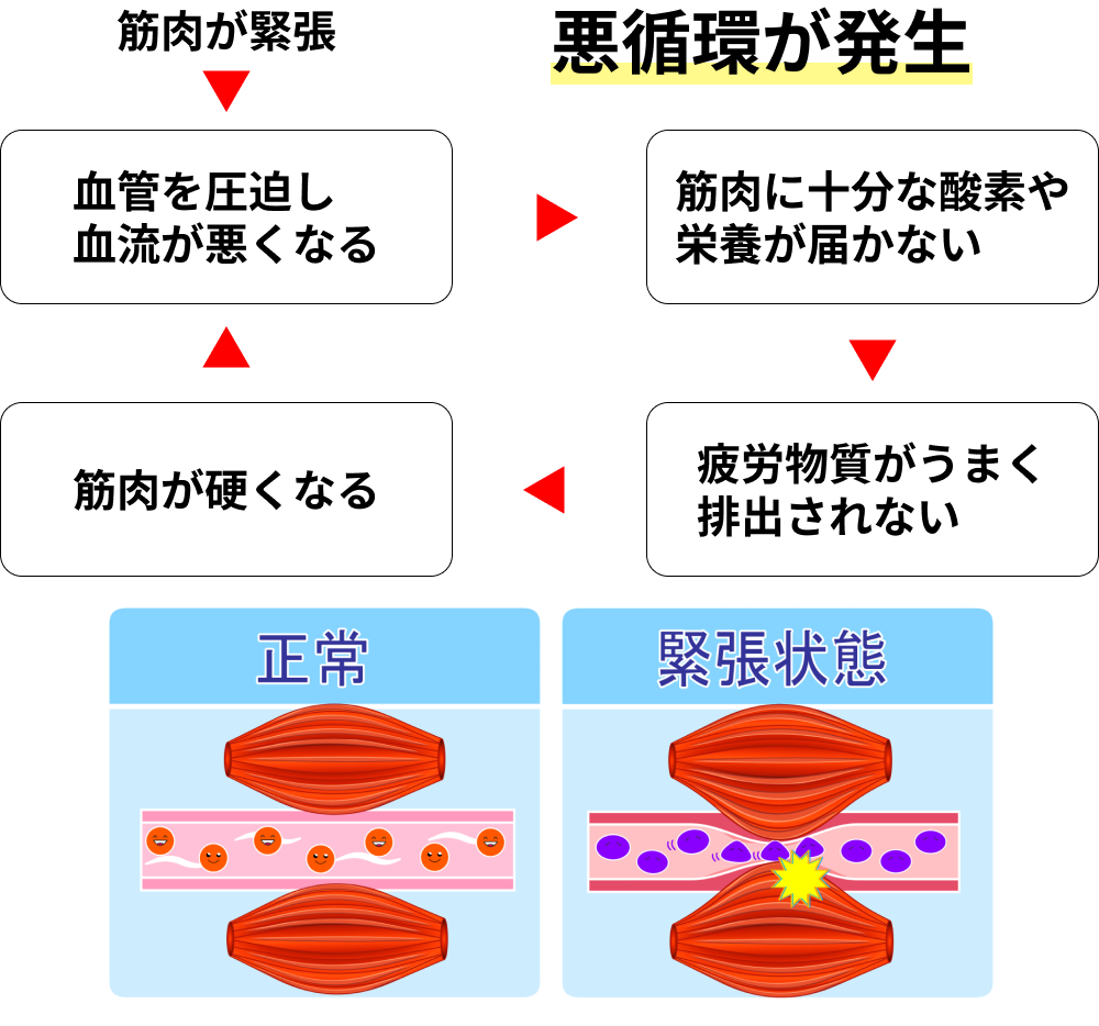 血行不良の解説イメージ