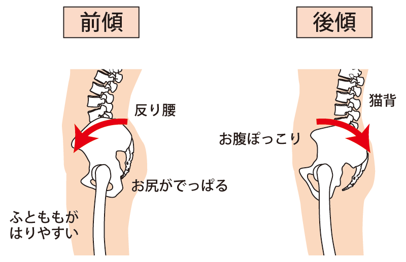 骨盤の傾きのイメージ