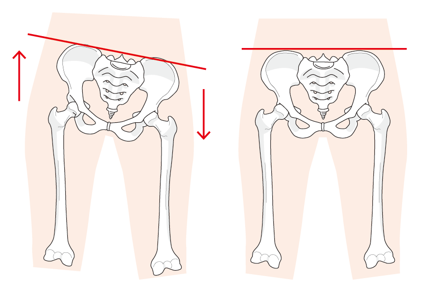 骨盤の傾きのイメージ